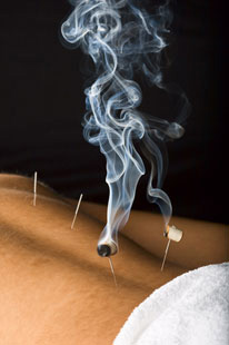 bournemouth-acupuncture